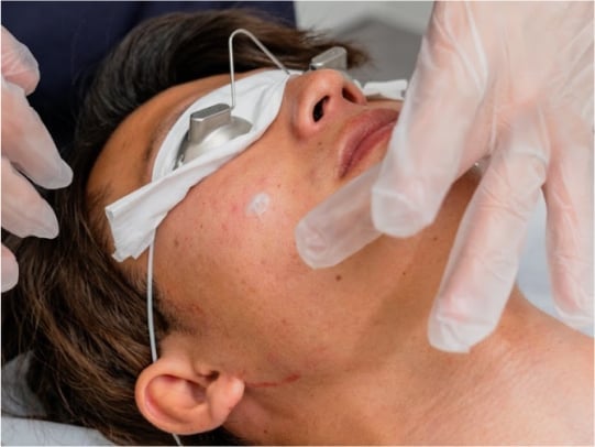 術後の炎症を抑える薬剤塗布