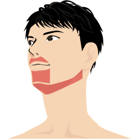 ヒゲ脱毛(3部位)