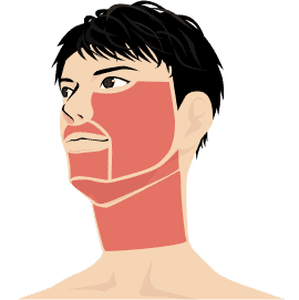 ヒゲ脱毛(全部位)