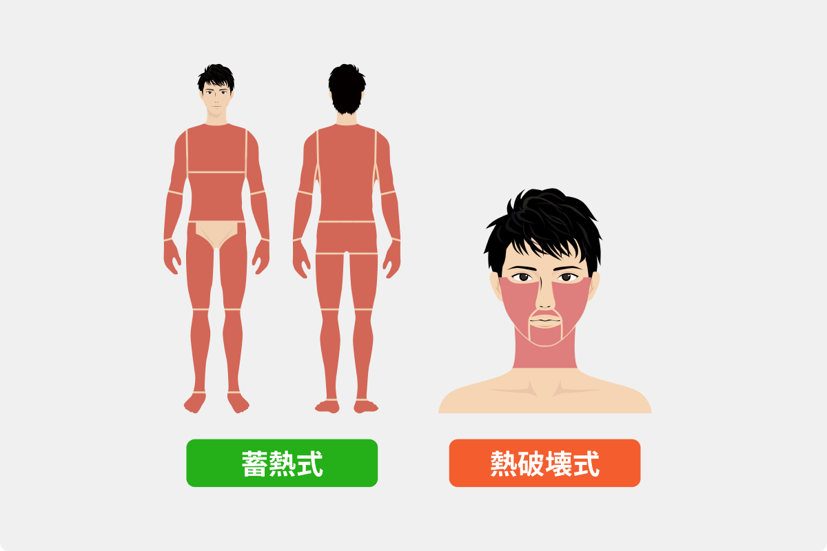 全身 + ヒゲ脱毛の照射範囲