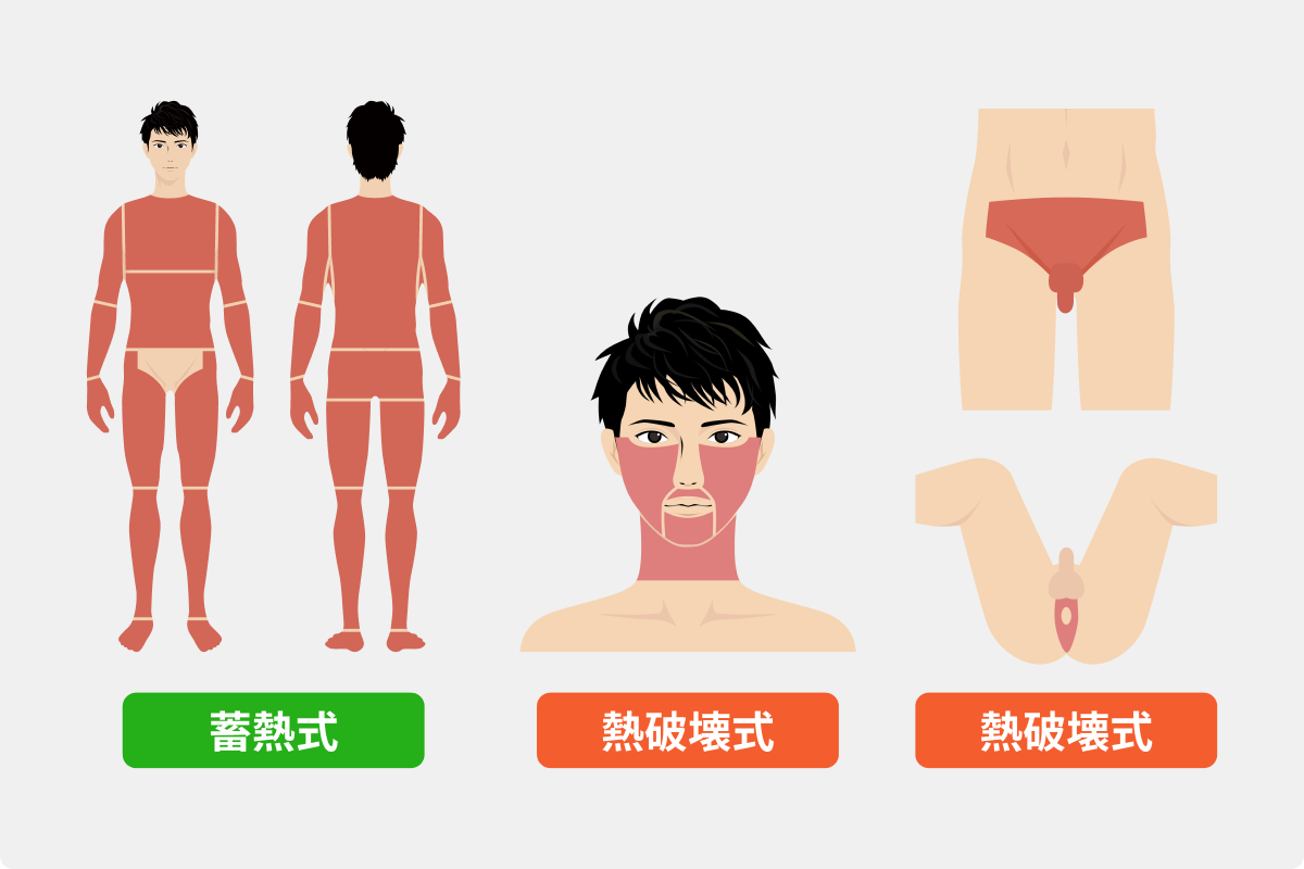 全身 + ヒゲ + VIO脱毛の照射範囲