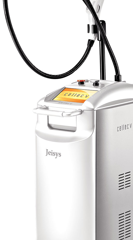 セレックV (IPL光治療)