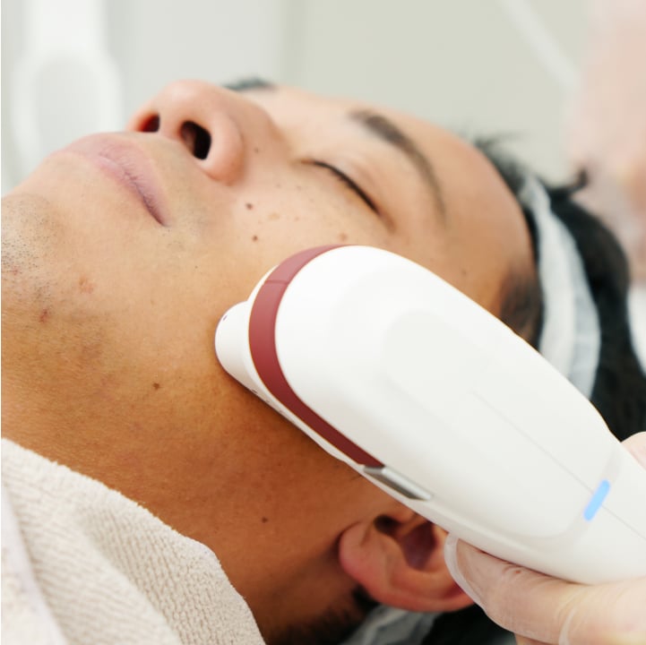 切らないリフトアップ治療