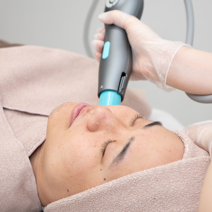 たるみの引き締め治療