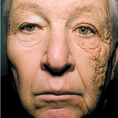 紫外線対策を徹底する