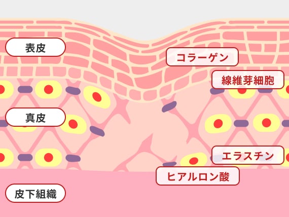 皮膚の弾力低下によるたるみ